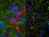 Before_After_AQX_Rat_Brain_Section[1]