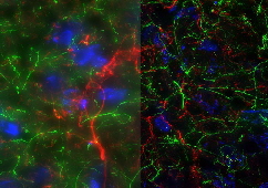 Before_After_AQX_Rat_Brain_Section